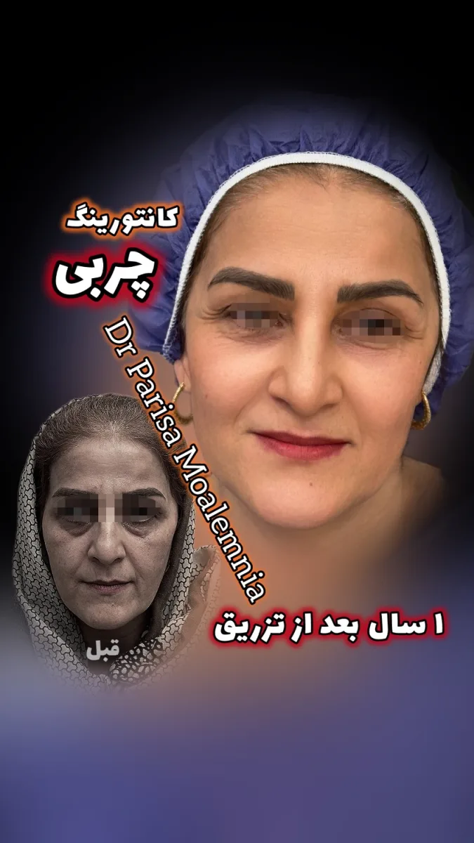 تصویر دکتر پریسا معلم نیا
